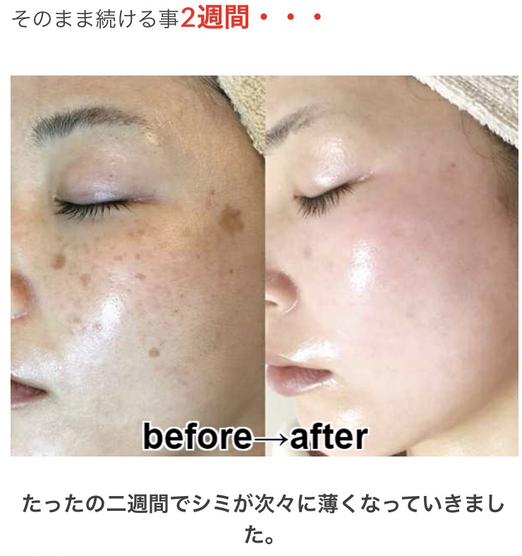 検証 知覚 薄める 出来 て しまっ た シミ に 効く 化粧品 Sozokobetsu Jp