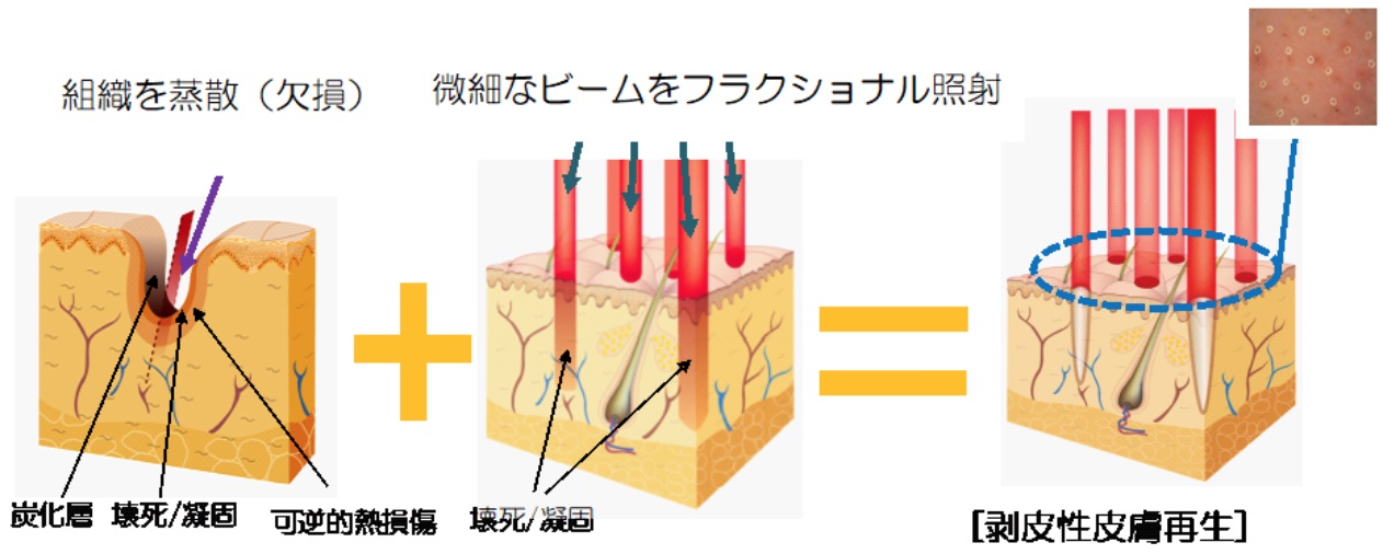 毛穴が目立つ７つの原因と対処法 Dr 松下ブログ 五本木クリニック
