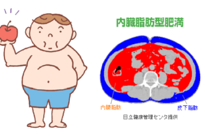 代謝症候群（Metabolic syndrome）に男女差はあるの？