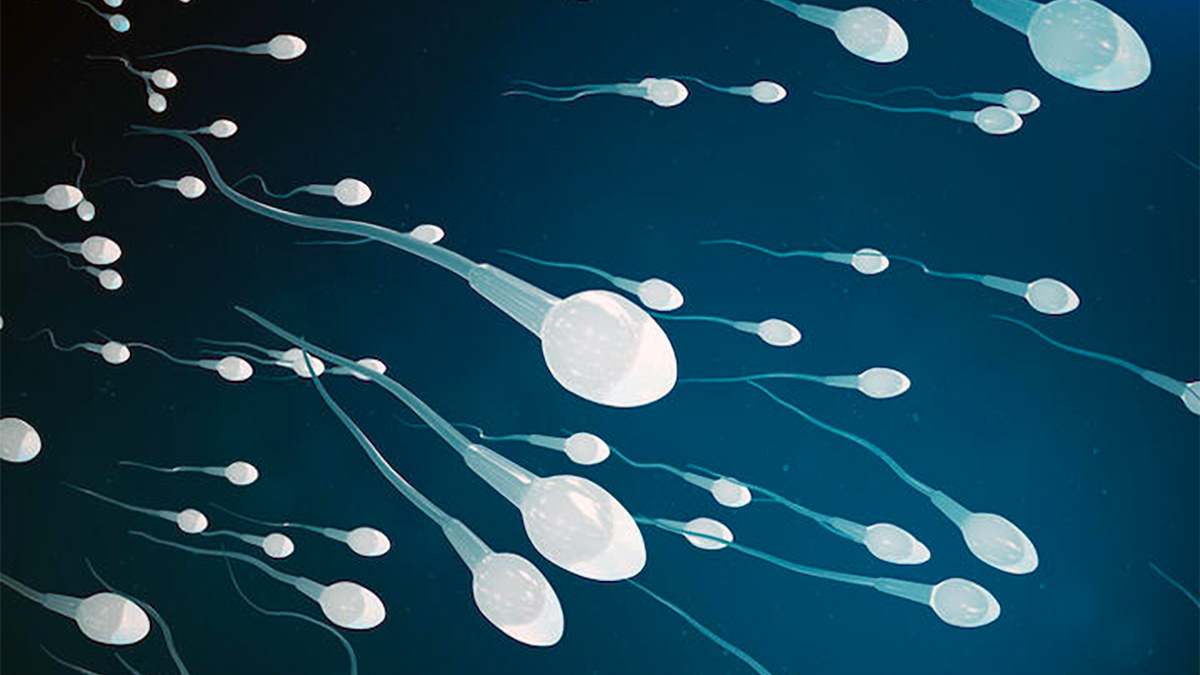 男性不妊症の原因が精子がない無精子症の場合、発がんリスクが８倍になるという驚きの論文