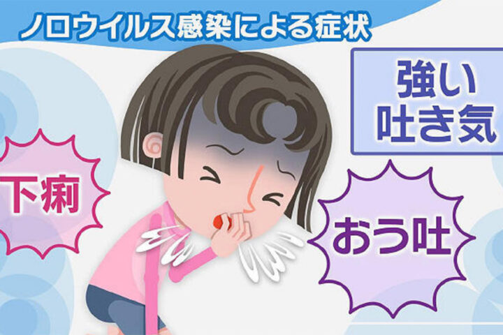 今年も大流行！ノロウイルスの診断は健康保険の対象外だった事に流行の原因があるかもしれない！