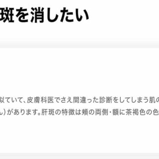 肝斑を消すならレーザートーニング