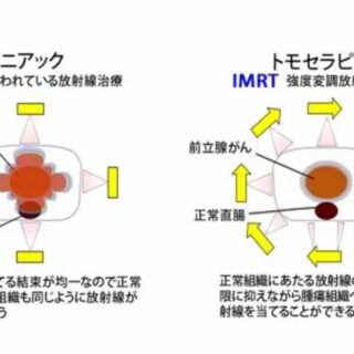 検査を薦める医者は金儲け主義