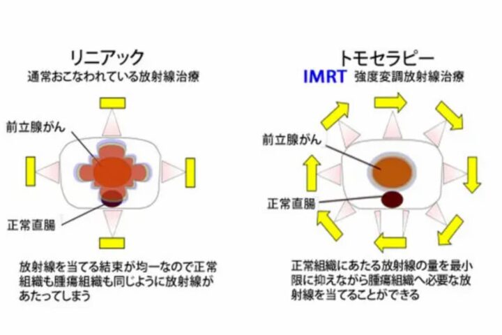 やっぱり医者は金儲け主義だ！という話