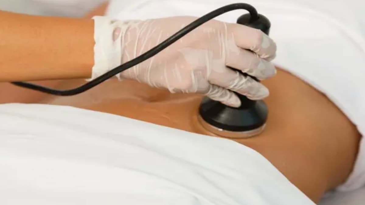 痩身施術で使われるエステのキャビテーションって効果あるのかな？ニセ