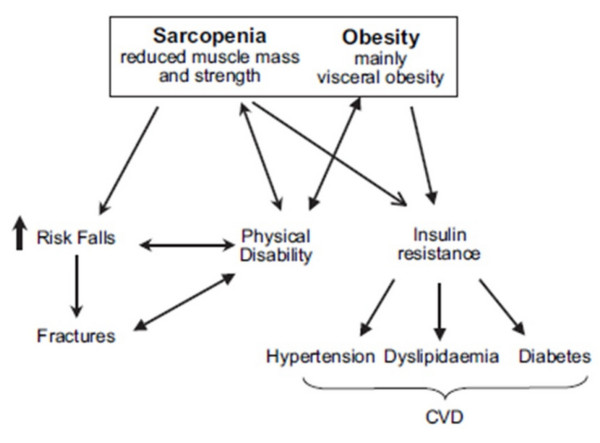 サルコペニアと肥満の関係