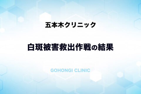 あのカネボウの白斑被害が集団訴訟になったが、当院での治療結果は？