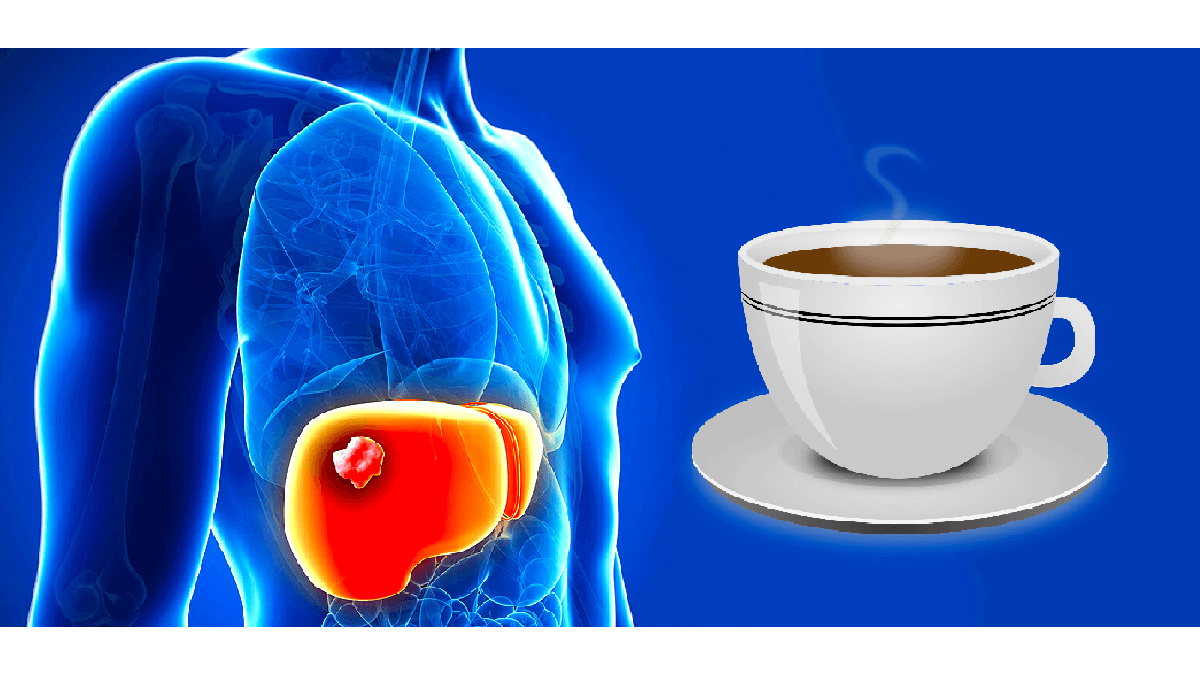 コーヒーで肝臓がんになりにくくなる説には注意が必要