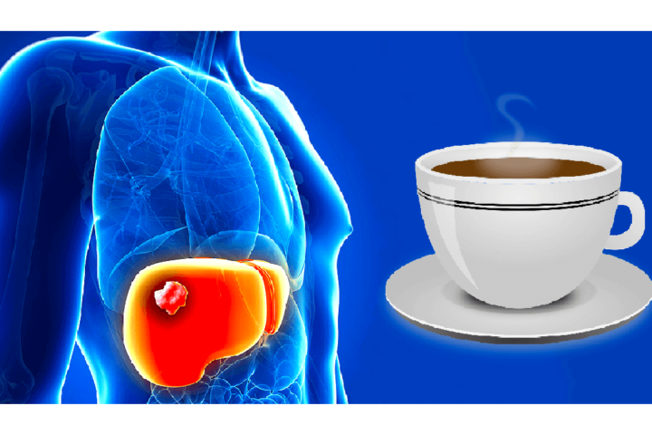今度はコーヒーを飲むと肝臓の「がん」になりにくいって説が登場、でも注意があります