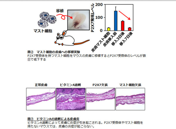 過剰なビタミンＡが引き起こす皮膚炎の原因を解明―線維芽細胞が司るマスト細胞の組織特異性のかく乱―