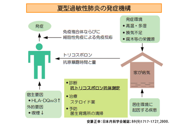 抗トリコスポロン・アサヒ抗体保険収載されました！