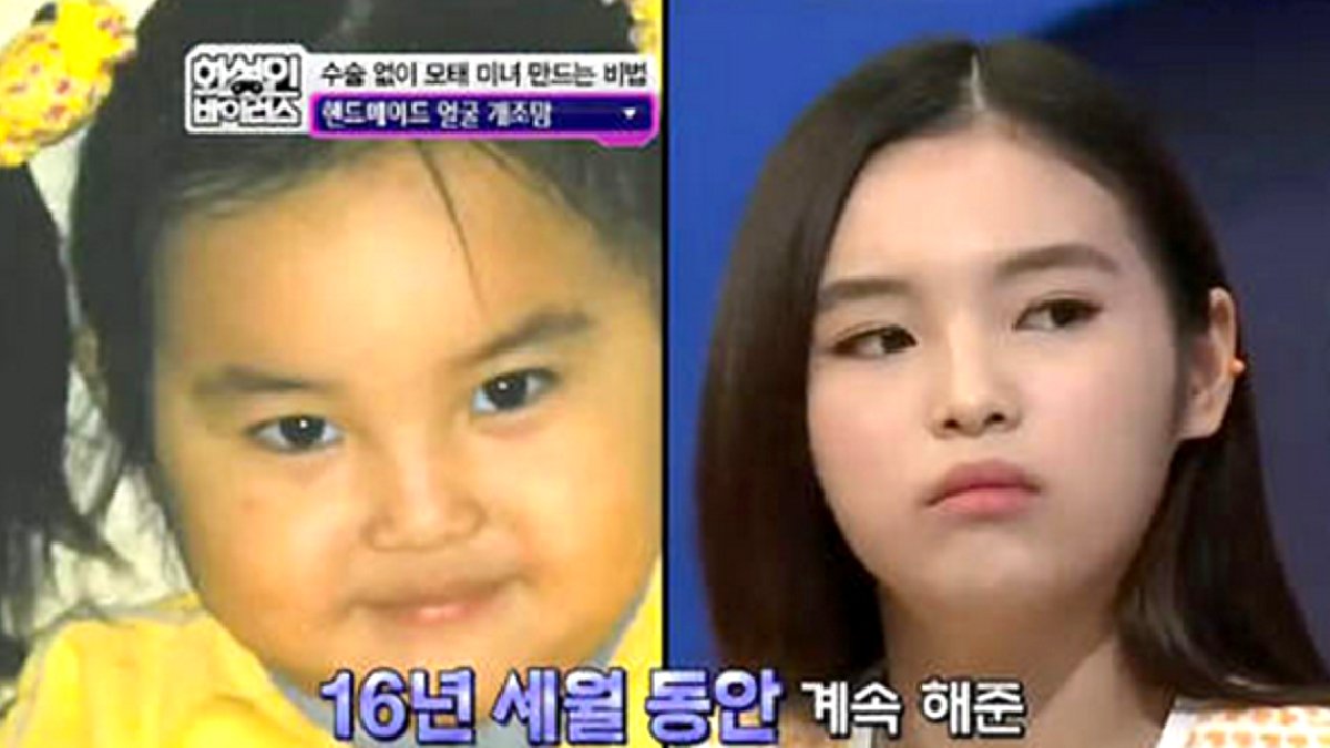韓国人親子の美容整形話