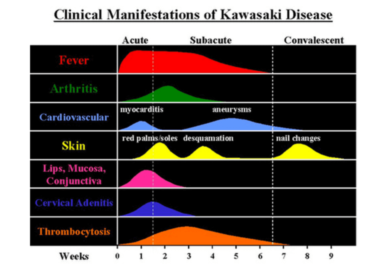 kawasaki-disease-from-china-1