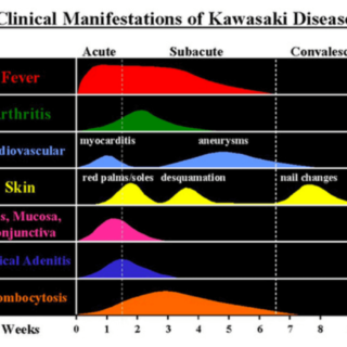 kawasaki-disease-from-china-1