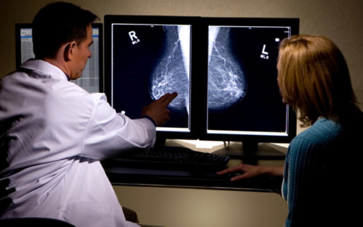 意味がないと思われがちなマンモグラフィ検診ですが乳がんの死亡リスクを28％減少させているという報告