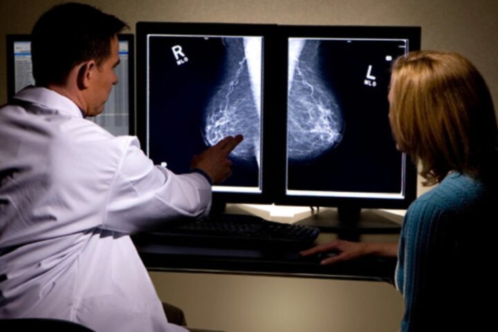 有効性に疑問のマンモグラフィ検診、乳がんの死亡リスクを28％減少させていました❗