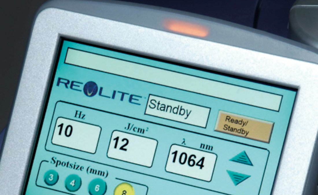 肝斑の治し方は、レブライト(REVLITE)でレーザートーニングが世界標準です。