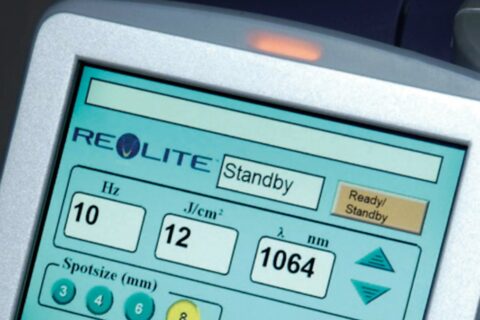肝斑の治し方は、レブライト(REVLITE) でレーザートーニングが世界標準です。