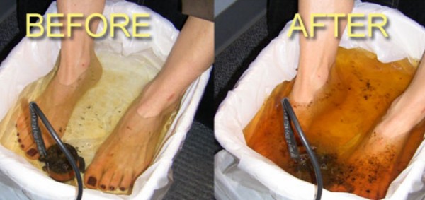 foot-detox_jpg__624×274_