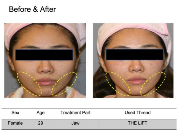 clinical_case_study_photos_THE_LIFT__1__pptx