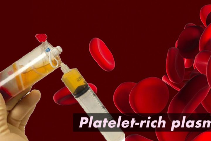 PRP療法は血小板と血漿を使って注射する美容治療方法です