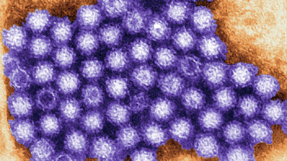 ノロウイルスは空気感染する可能性