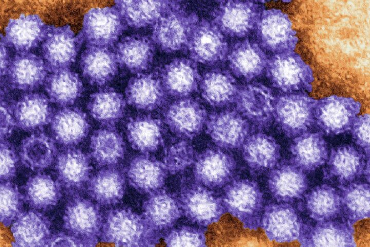 ノロウイルスは空気感染する、という話は本当か⁉