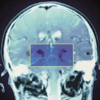 MRIニセ医学は治療費が高額なほど効果的