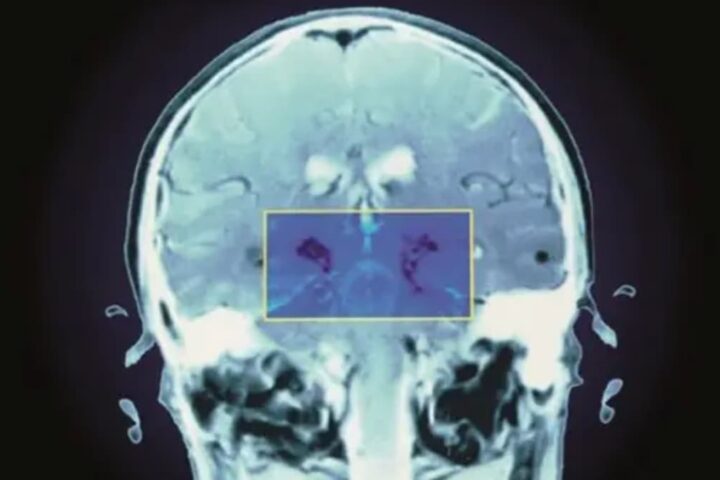 納得！疑似医学・インチキ医療で病気が治る場合もあるけど、高額な治療費が効果の秘訣？？