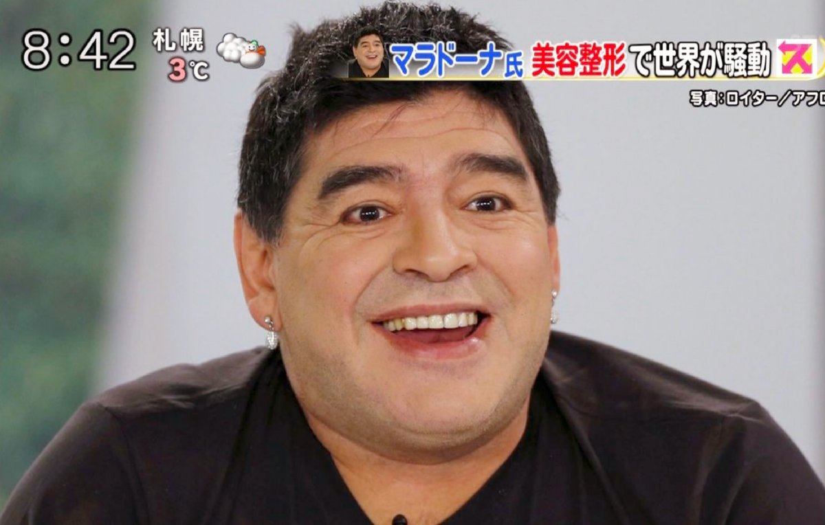 マラドーナが整形 失敗ではないけど オバさんになって ママドーナ 院長ブログ 五本木クリニック マラドーナが整形 失敗ではないけど オバさんになって ママドーナ 院長ブログ 五本木クリニック