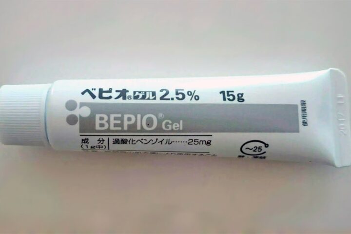 【朗報】ニキビ治療の新薬「ベピオゲル」が保険適用❗BPO 過酸化ベンゾイルが主成分で世界標準のにきび治療が可能に❗