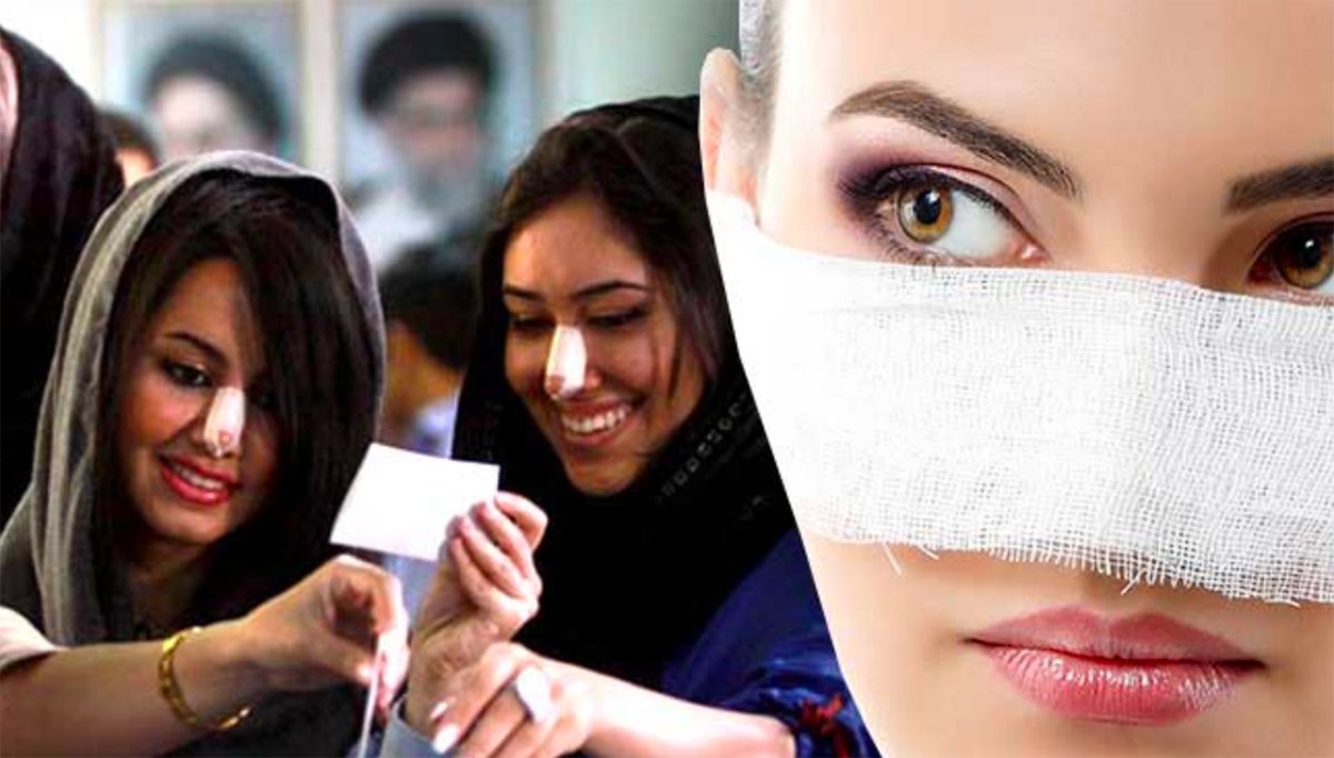 イランは美容整形大国・鼻の手術が大人気