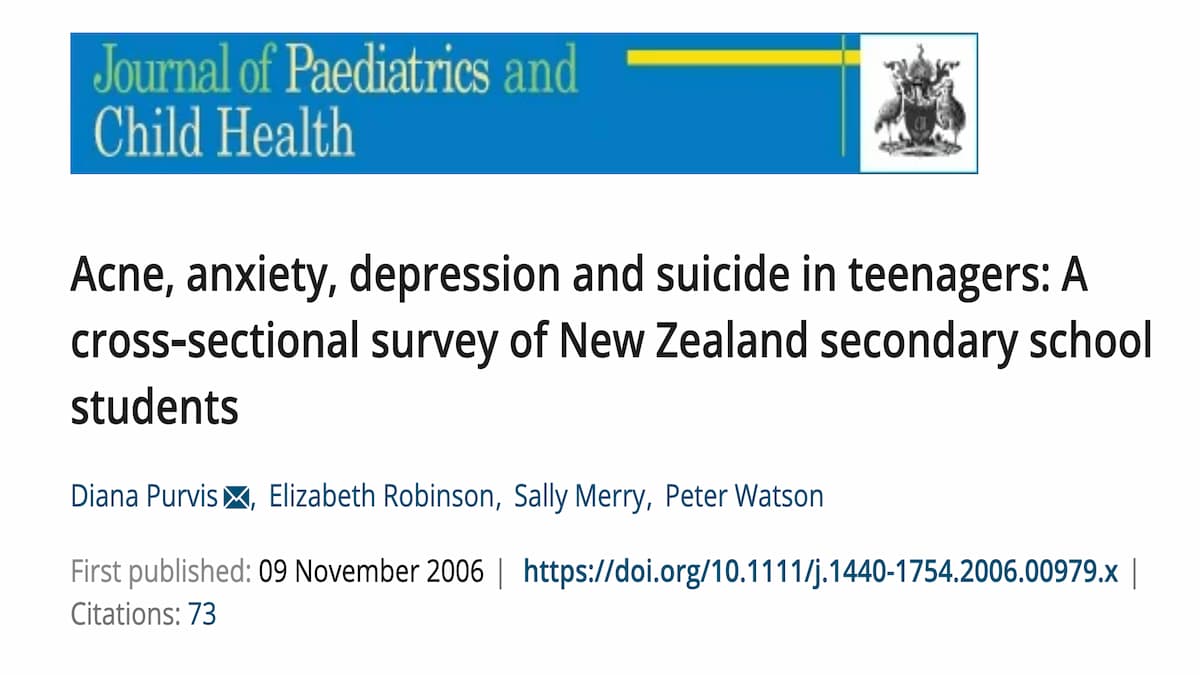ニキビに悩む１０代の若者の３分の１に自殺願望、治療する医師側に問題あり！追記あり