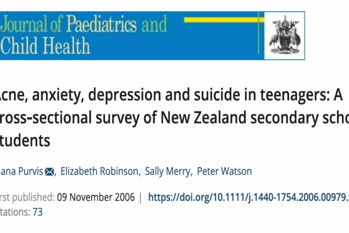 ニキビに悩む１０代の若者の３分の１に自殺願望、治療する医師側に問題あり！追記あり