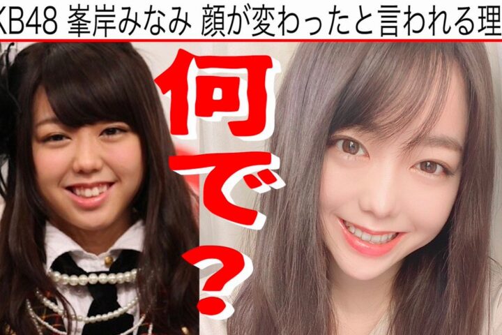 AKB 峯岸みなみさんの整形疑惑に喝❗を入れる