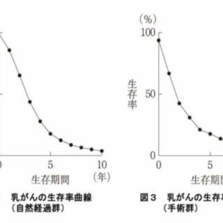 100年前の乳がんの治療成績