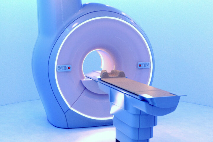 強く頭を打った時「CTお願いします」は間違いです❗検査によって「がん」の危険が高まる？？