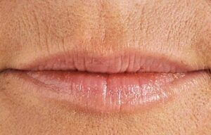 23_lips_as_we_age