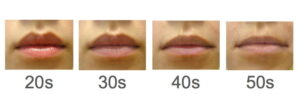 drs31