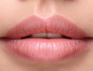 lip-fillers-brisbane-mjapflo0gt6wmioyp4bzp7zr86vtf12bby0atex3ts