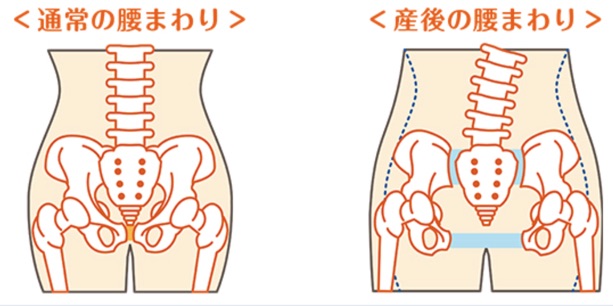 産後の骨盤の歪み問題 ここまで歪んだら普通死んじゃうよ 院長ブログ 五本木クリニック