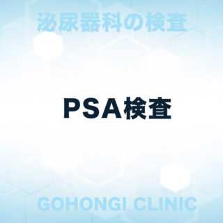 PSA検査｜泌尿器科｜五本木クリニック（東京都目黒区）