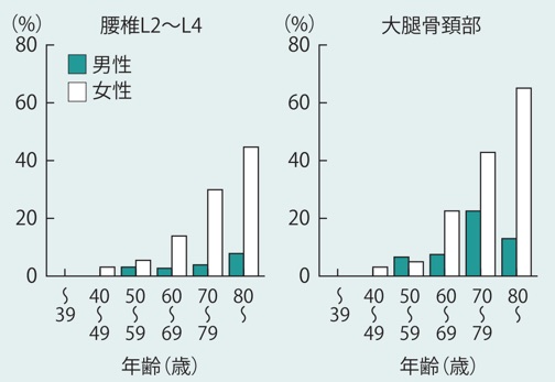 【悲報】やっぱりサプリって必要ないようです、特に骨関係のサプリ。