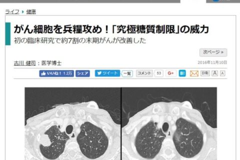 がん免疫栄養ケトン食療法、なんだか怪しげな雰囲気が⋯。