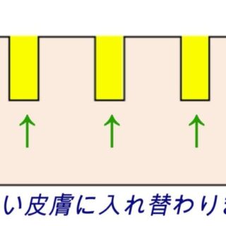 7edc75dffb3dc83a0b27f858260eec8d-e1522287970779