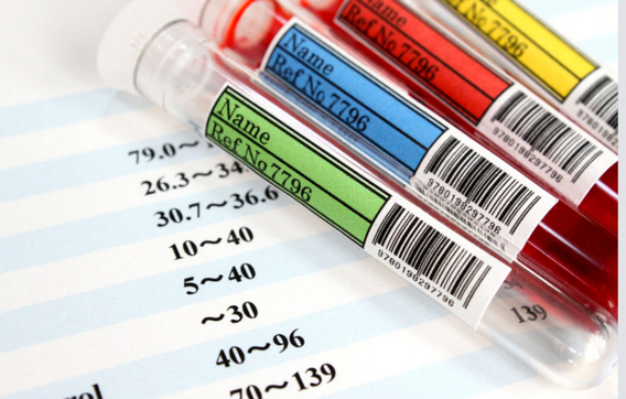 自殺を予知する血液検査⁉本当に自殺予防方法が効果あるのか？