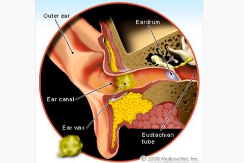 危険❗綿棒は耳に突っ込んではいけません、正しい耳掃除の方法は意外でした。