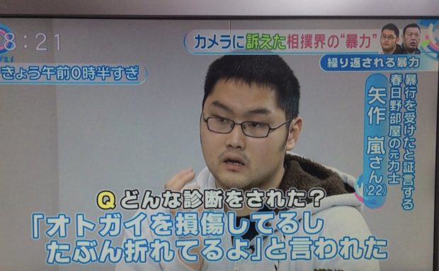 大相撲問題：暴行で顔がゆがんだ、整体に行け❗それ接骨院か整形外科の間違いじゃないの？