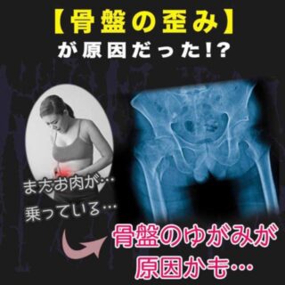 何もかも歪みのせいにするのは簡単ですし一見もっともらしく見えますが、ただの適当なデマの可能性大