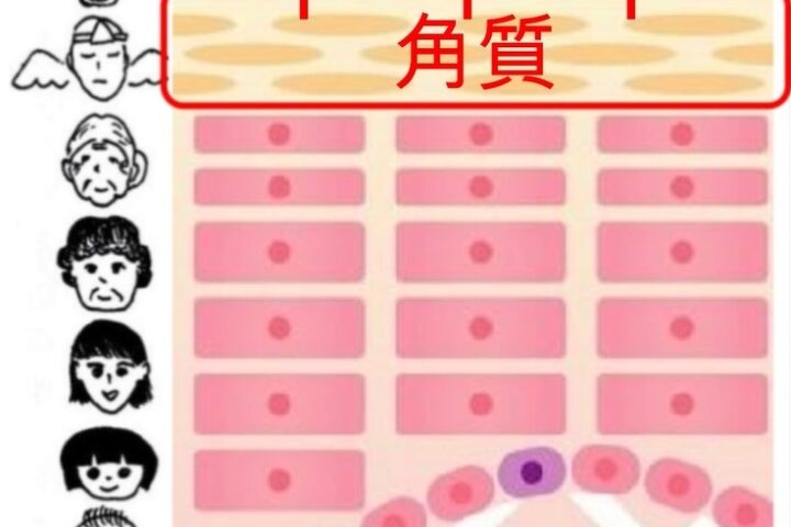 ピーリングは美肌治療の基本中の基本！ピーリングなくして美肌は成しえない理由を説明します